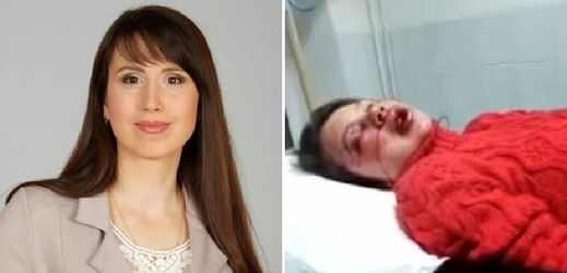 Teťjana Čornovolová před a po přepadení.