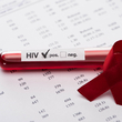 Stovky čechů nevědí, že žijí s HIV