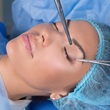 Vše, co chcete vědět o operaci očních víček